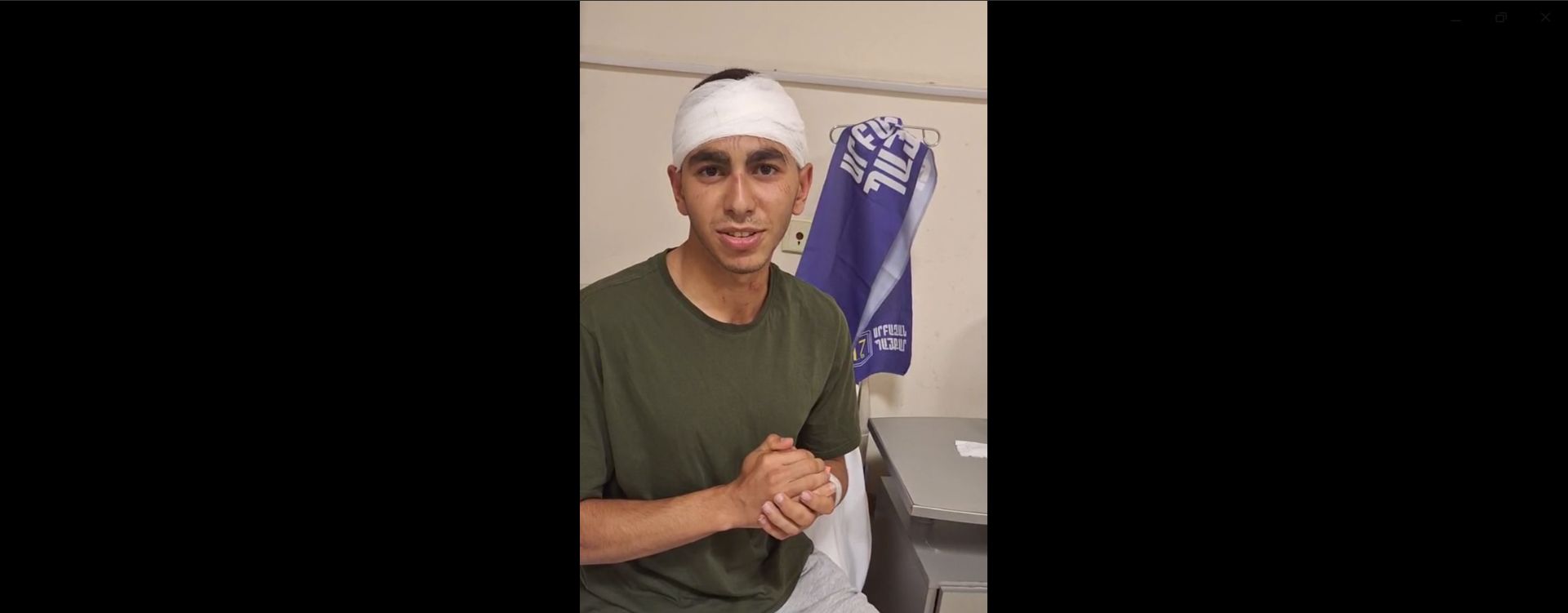 Կարմիր բերետավորի կոշիկի հետքը՝ ակցիայի մասնակից Արման Սարգսյանի դեմքին (լուսանկար, տեսանյութ)