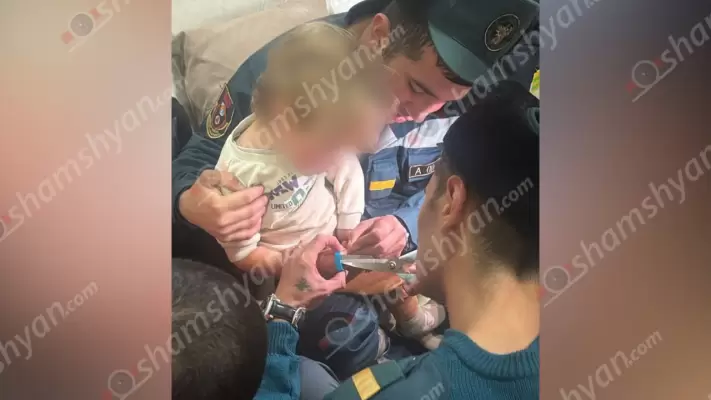 Երևանում հրշեջ-փրկարարները օգնության են հասել 2.5-ամյա տղային, որի մատն արգելափակվել էր պլաստմասե խցանում