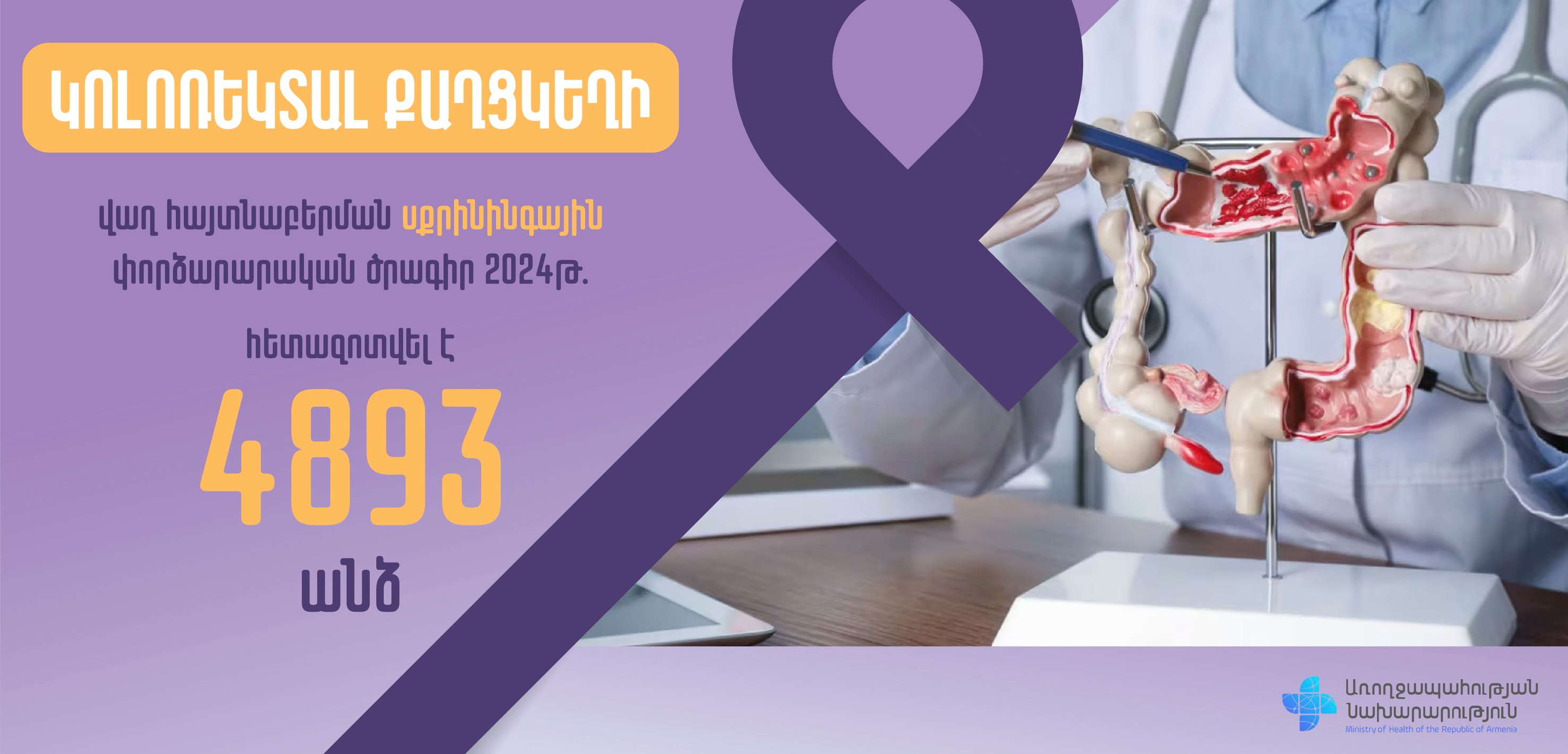 «Կոլոռեկտալ քաղցկեղի վաղ հայտնաբերման սքրինինգային փորձարարական ծրագրի» մեկնարկից մինչ օրս հետազոտվել է ավելի քան 9 հազար անձ