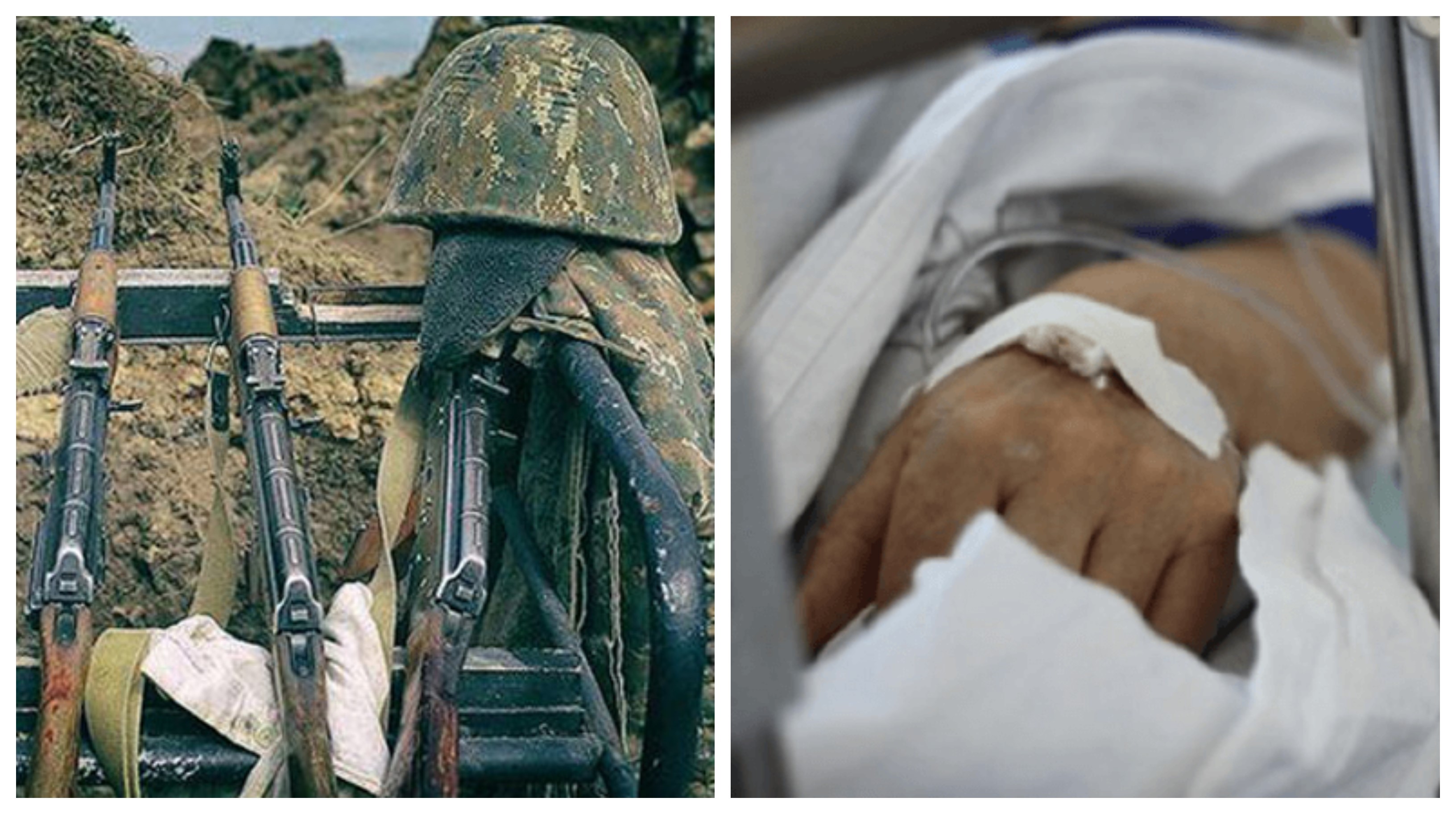 Ադրբեջանական կրակոցներից վիրավորում ստացած 3 զինծառայողների վիճակը բավարար է