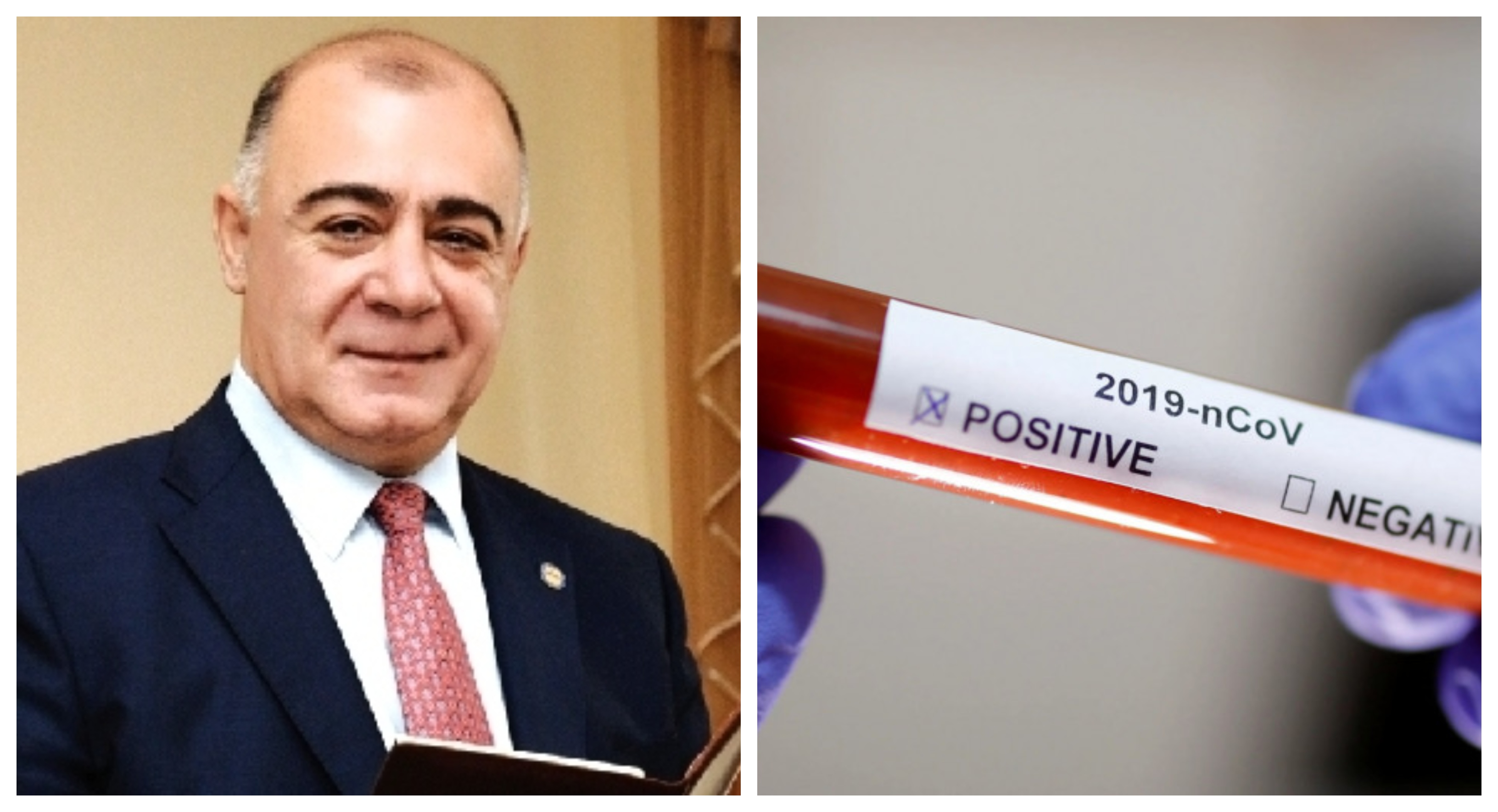 Սամվել Բալասանյանը վարակվել է կորոնավիրուսով